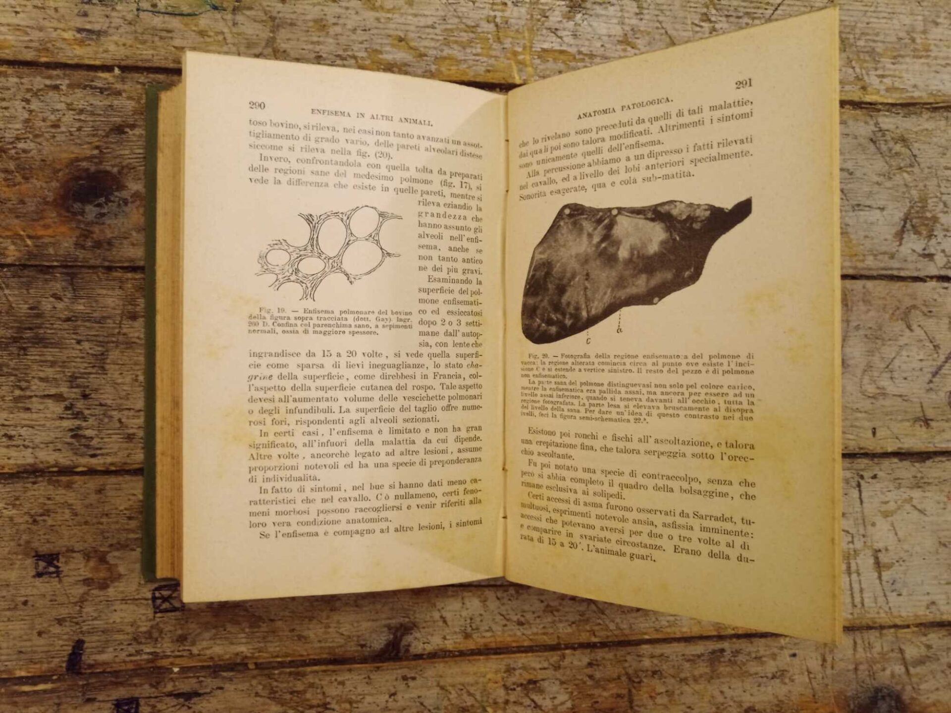 Malattie dell'apparato respiratorio - immagine 4